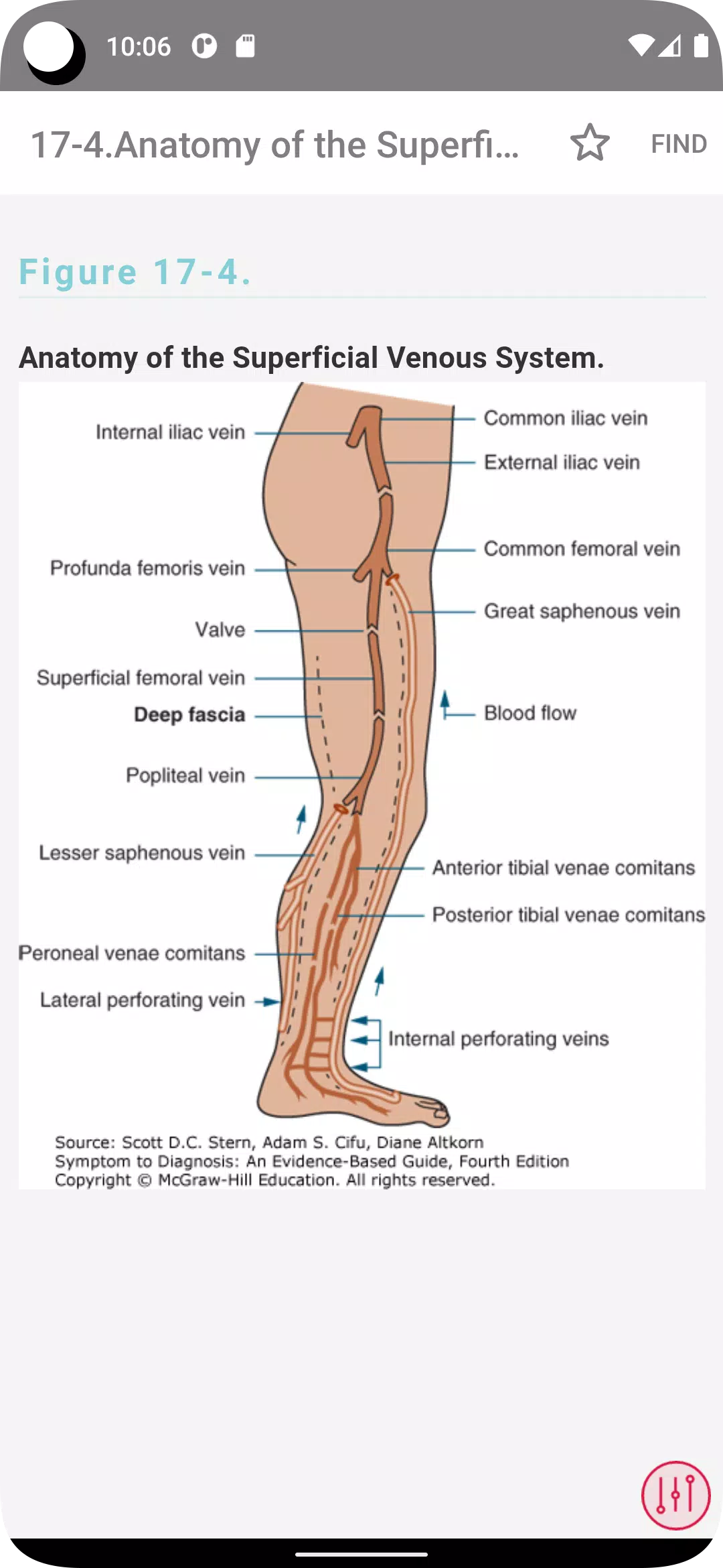 Symptom to Diagnosis Ảnh chụp màn hình 1